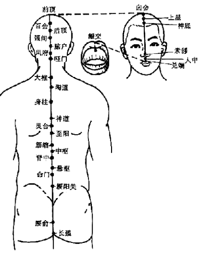 艾灸疗法治疗颈椎病(图)